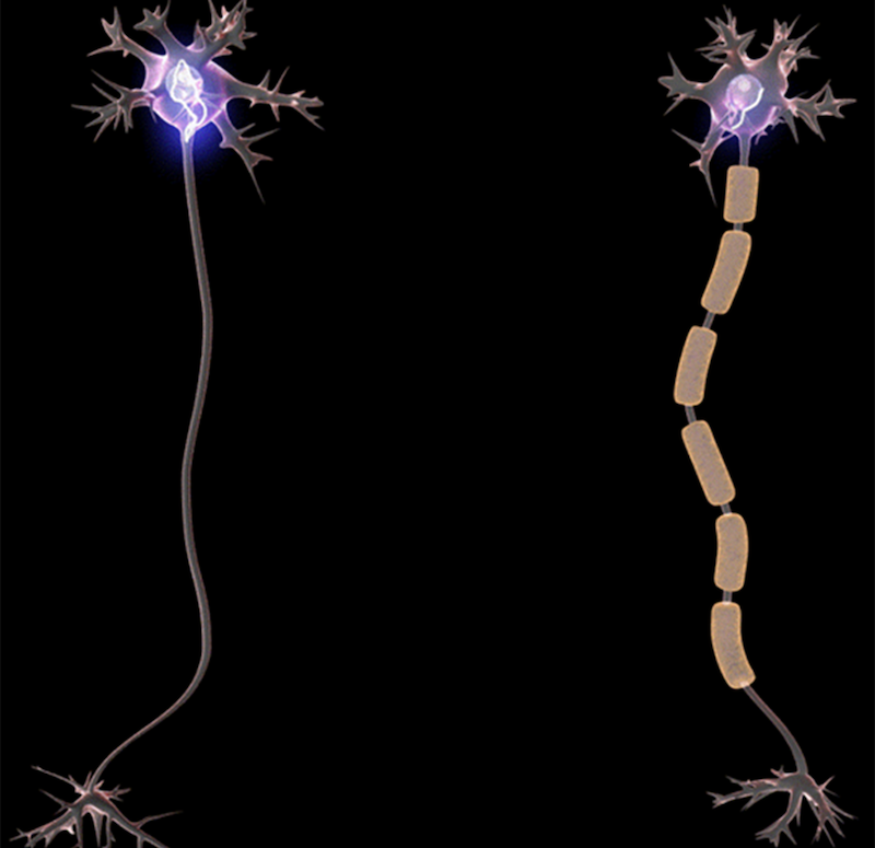 So sánh việc truyền tin khi có và khi không có myelin dày. Ảnh: Wikipedia.